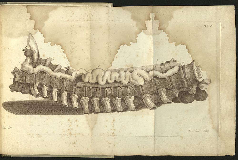 Cruickshank's The Anatomy of the Absorbing Vessels of the Human Body, 1790