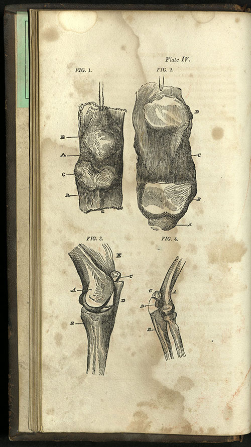 Charles Bell, A System of Operative Surgery, 1812